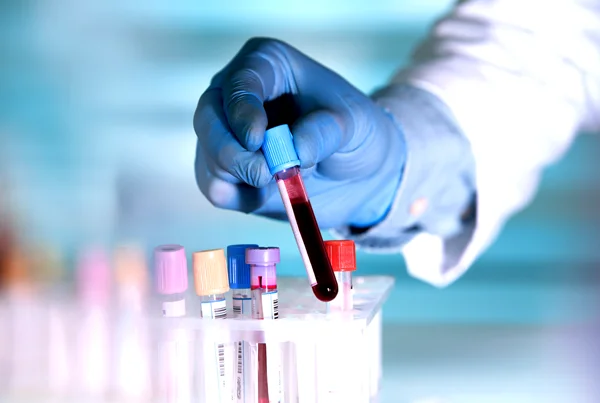 Blood Test