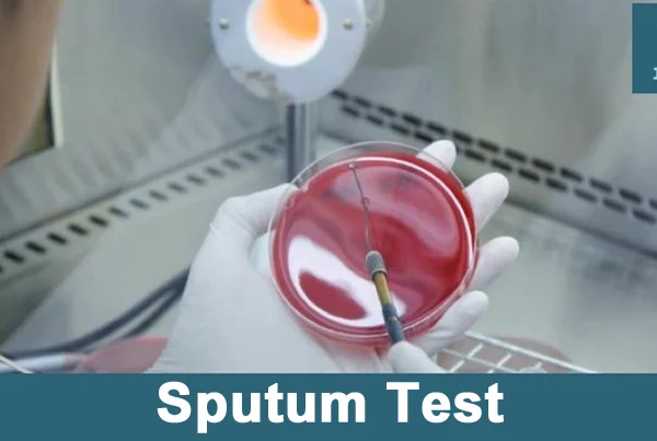 Sputum Test