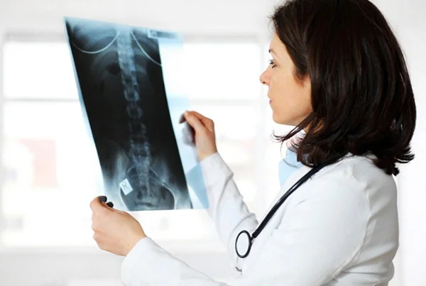 X-Ray