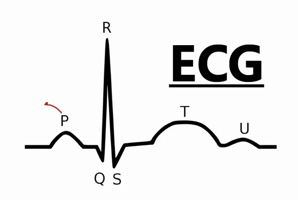 ECG Test